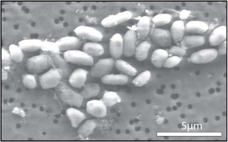 GFAJ-1 grown on arsenic GFAJ-1 grown on arsenic